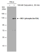 Anti-IRE1 alpha (phospho Ser724) antibody used in Western Blot (WB). GTX130378